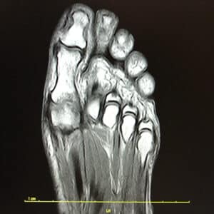 Immagine di RMN Piede eseguito presso X-Ray Ultrasound
