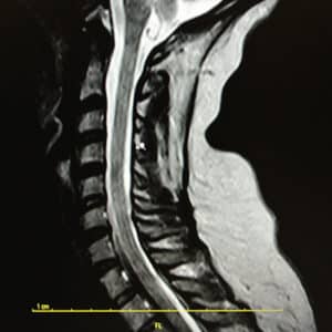 Immagine di RMN Rachide cervicale eseguito presso X-Ray Ultrasound
